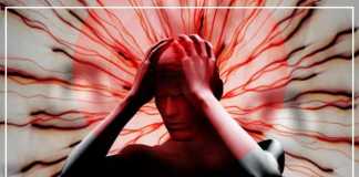Natural Treatment for Migraine