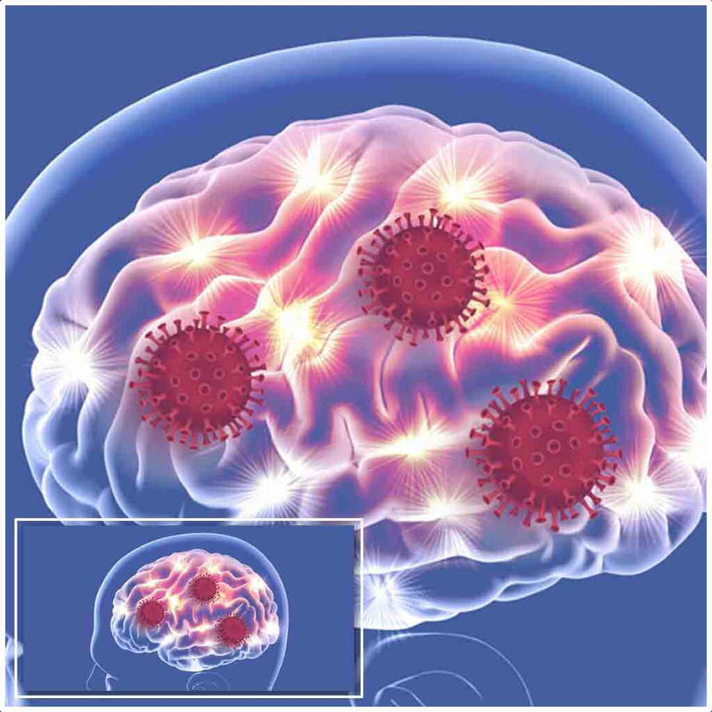 Nipah Virus