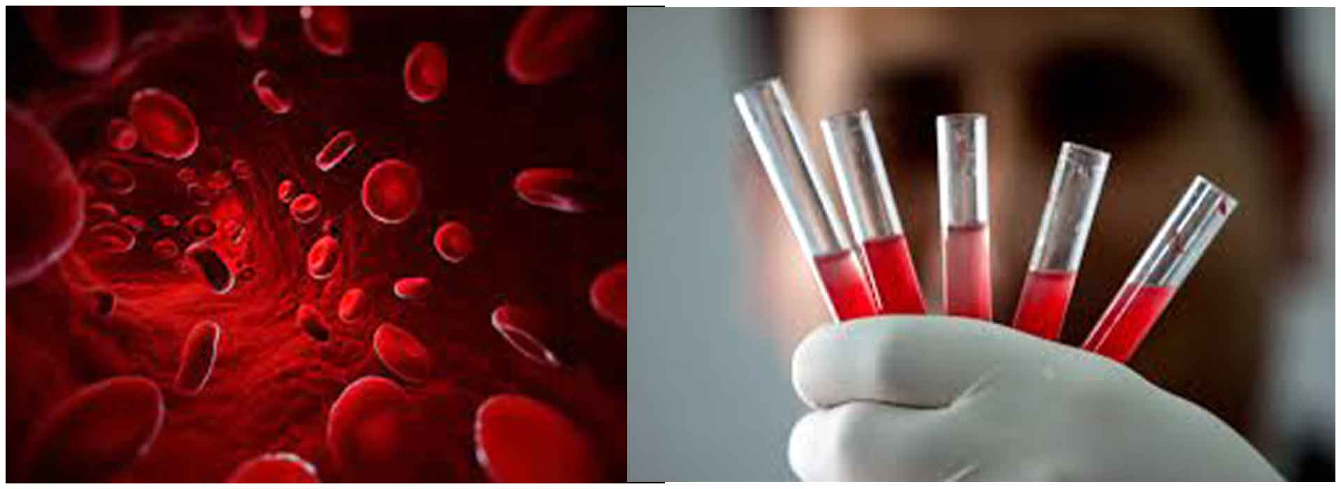 NHS Blood and Transplant-led study identifies new blood group system MAL advancing medical knowledge